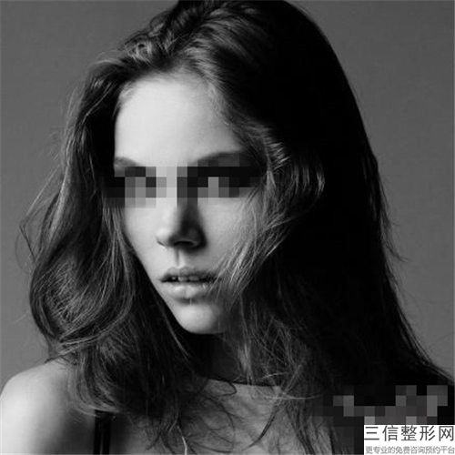 南京玻尿酸注射墊下巴術(shù)的價(jià)格大約在多少