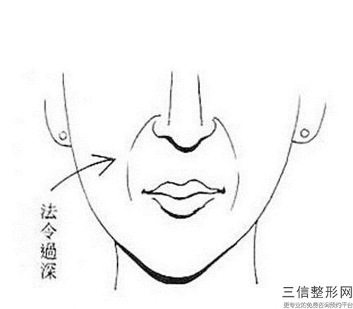 昆明手術(shù)去除紋身手術(shù)的風(fēng)險(xiǎn)你知道嗎