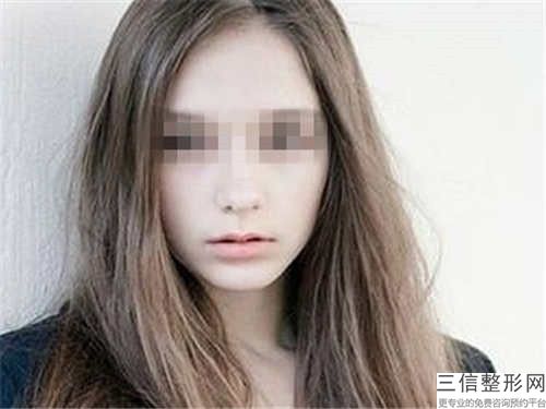 深圳市唇腭裂的修復(fù)收費(fèi)明細(xì)表查詢-均價(jià)唇腭裂的修復(fù)24840元
