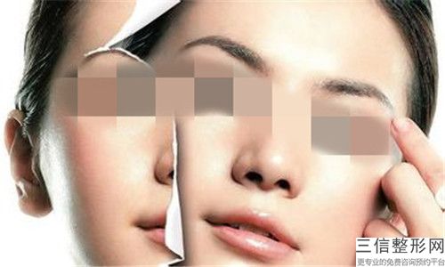 重慶整容耳朵一次的價(jià)格通常與什么有關(guān)