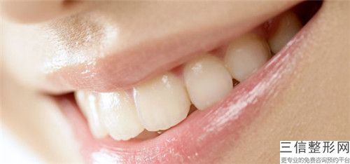 蘭州拔門牙正畸術(shù)適合哪類人群