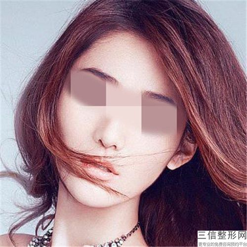 減下巴容醫院推薦：減下巴醫院前30佳哪個靠譜安全