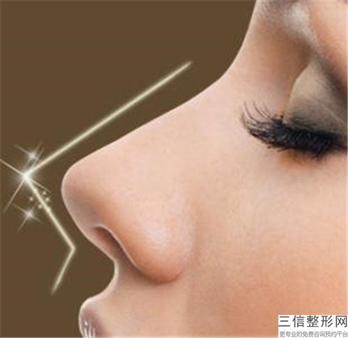 濟南槐蔭美媛素醫療美容整形醫院整形費用表明細完整版-縮鼻翼修復案例