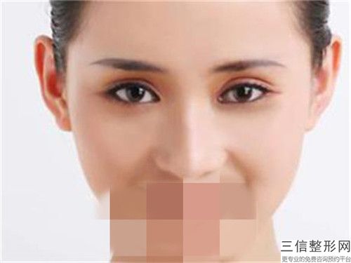 保定姮美整形美容醫院天生耳朵畸形治療的副作用是什么呢