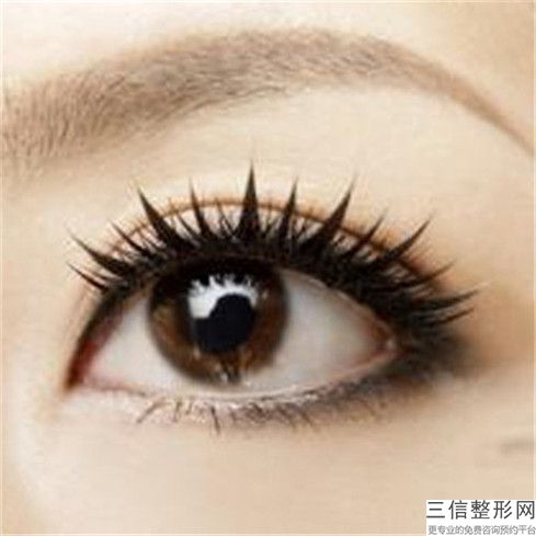 湯文山整形醫(yī)生-云南省湯文山醫(yī)生眼睛點(diǎn)黑眼圈上榜理由透明