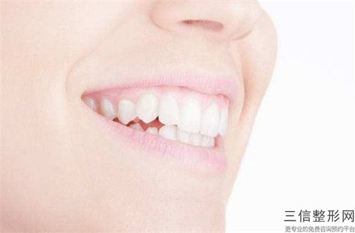 保定悅容醫療美容牙齒橋體修復術后常發生的9種后遺癥