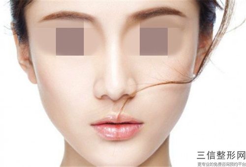 自體隆鼻假體隆鼻手術有什么壞處