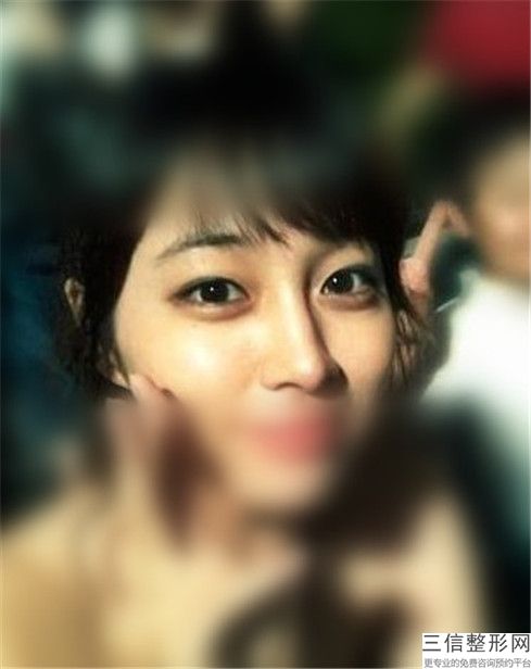 郭妤整形醫(yī)生-上海市郭妤醫(yī)生成年脊柱側(cè)彎矯正技術(shù)好有特色