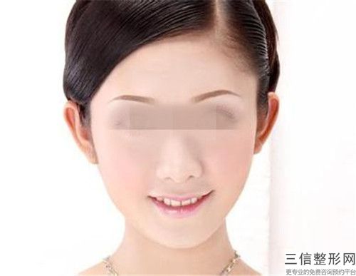 瘦臉針溶脂針后會(huì)產(chǎn)生什么副作用嗎