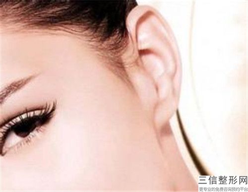 先天性小耳畸形整形術(shù)做一次能持續(xù)多久