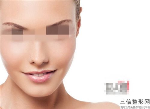 面部除皺整形有何優勢 能維持多久