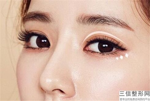 淄博市腫泡眼割雙眼皮價(jià)格表爆出-淄博市腫泡眼割雙眼皮醫(yī)院手術(shù)一般要多少價(jià)格