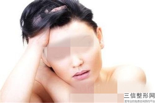 全國臉祛痘印手術王是哪個整形醫生：臉祛痘印手術醫生前50強醫美機構匯總