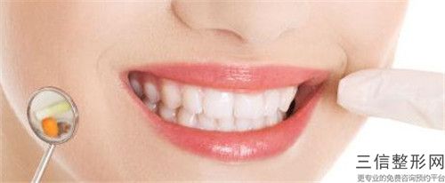 張 賓正畸牙齒托槽的維持時(shí)間