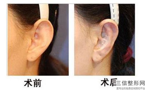 棗莊市口腔醫(yī)院整形科做微創(chuàng)手術(shù)耳朵價(jià)目表好評(píng)醫(yī)生-附整形價(jià)格表
