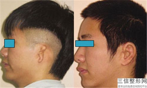 國內(nèi)哪個整形醫(yī)院整形豐耳垂良好：整形豐耳垂醫(yī)院前50位驚喜亮相