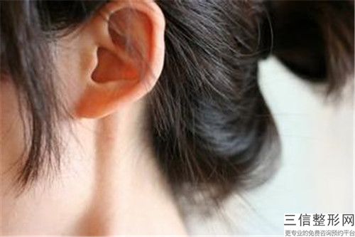 石家莊市人民醫院整形美容中心價格表2025更新上線-耳甲腔畸形案例