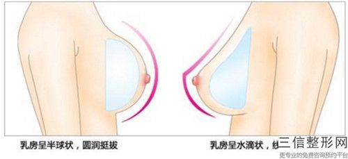 杭州隆胸吸脂整形方法適合哪類人