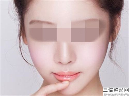 銀川市面部凹陷膠原蛋白醫院在榜名單口碑派入圍，想做整形就找他（銀川市面部凹陷膠原蛋白整形醫院）