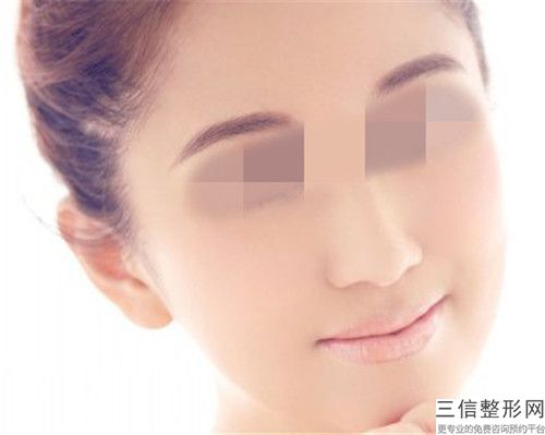 宜昌激光治療雀斑天洗臉后要多久見效