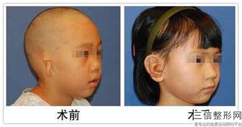 寧夏回族自治區做人造耳朵醫院推薦：做人造耳朵醫院前30位權威榜單整理