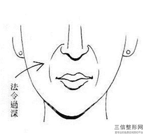溫州除皺較價(jià)格一般是多少錢(qián),溫州除皺較手術(shù)價(jià)格是怎樣的