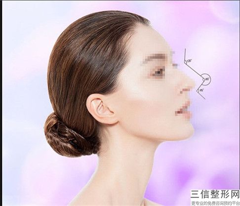 自體脂肪隆鼻尖會(huì)對(duì)面部產(chǎn)生不良影響嗎
