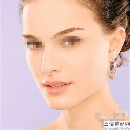 長沙下巴長做手術整形手術的效果好不